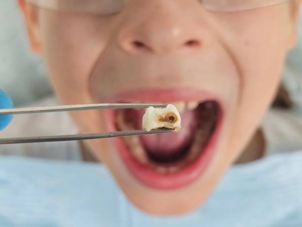 Best Emergency TMJ Treatment in Holly Springs, NC